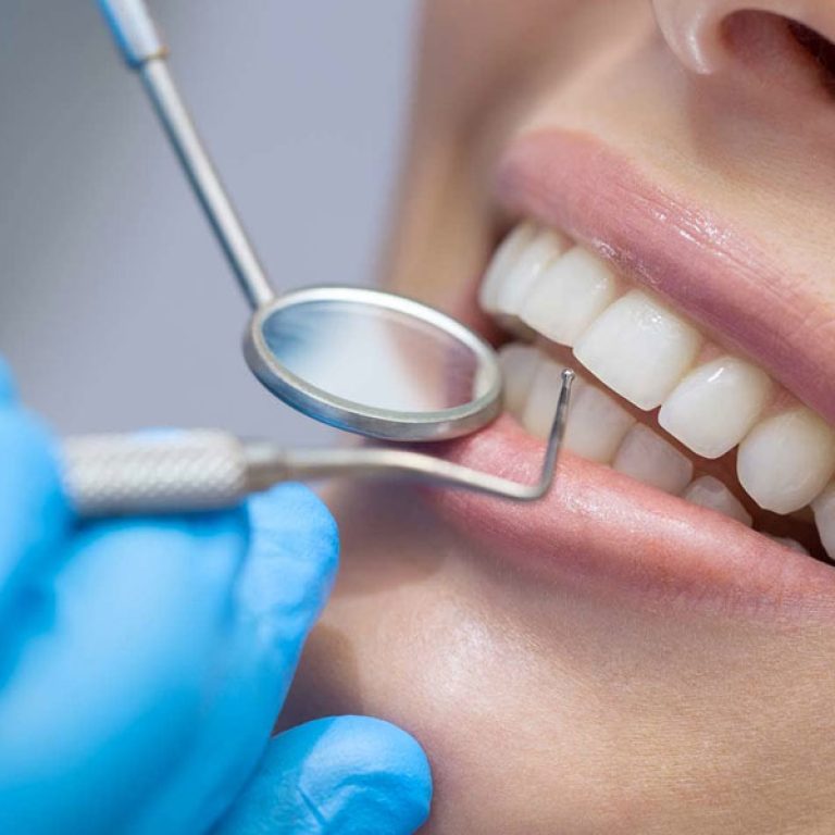 Periodontal-Exams