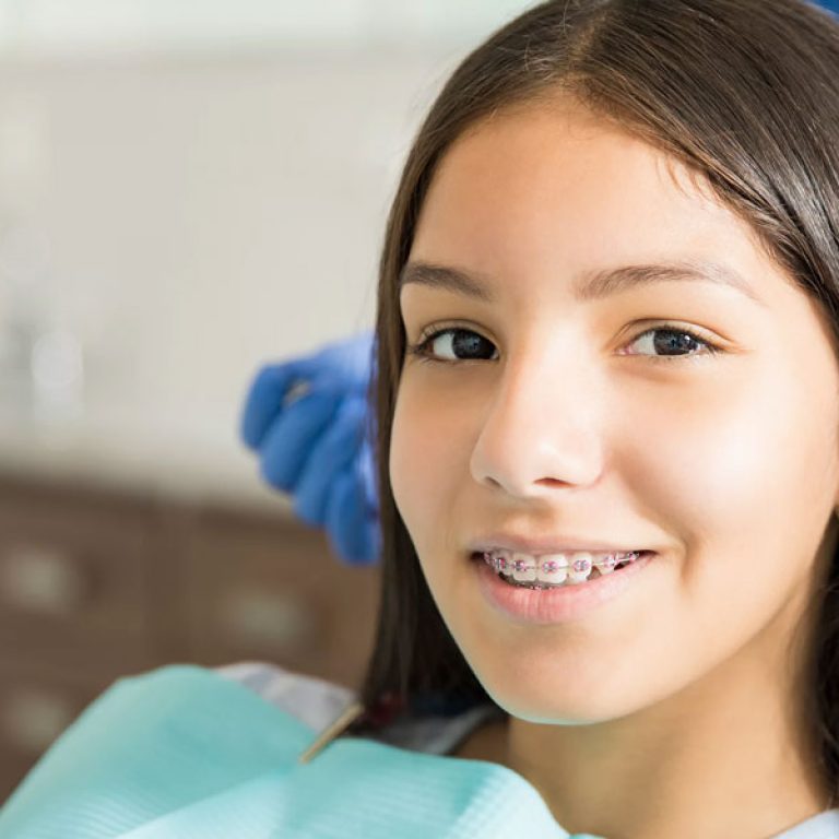 braces